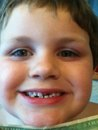 A photograph of Cody showing off his smile after losing his first tooth...