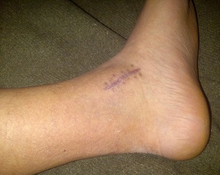 The inside of my left ankle.