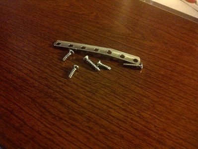 The last of the hardware that was in my leg.