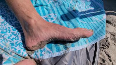 What happens when you get stung by a jellyfish!